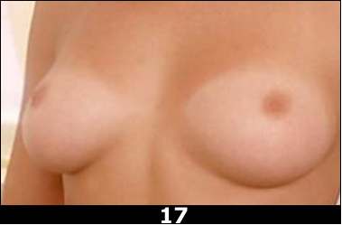 Фотография 17 настоящие или силикон ?