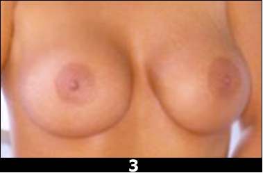 Фотография 3 настоящие или силикон ?