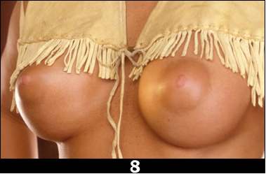 Фотография 8 настоящие или силикон ?