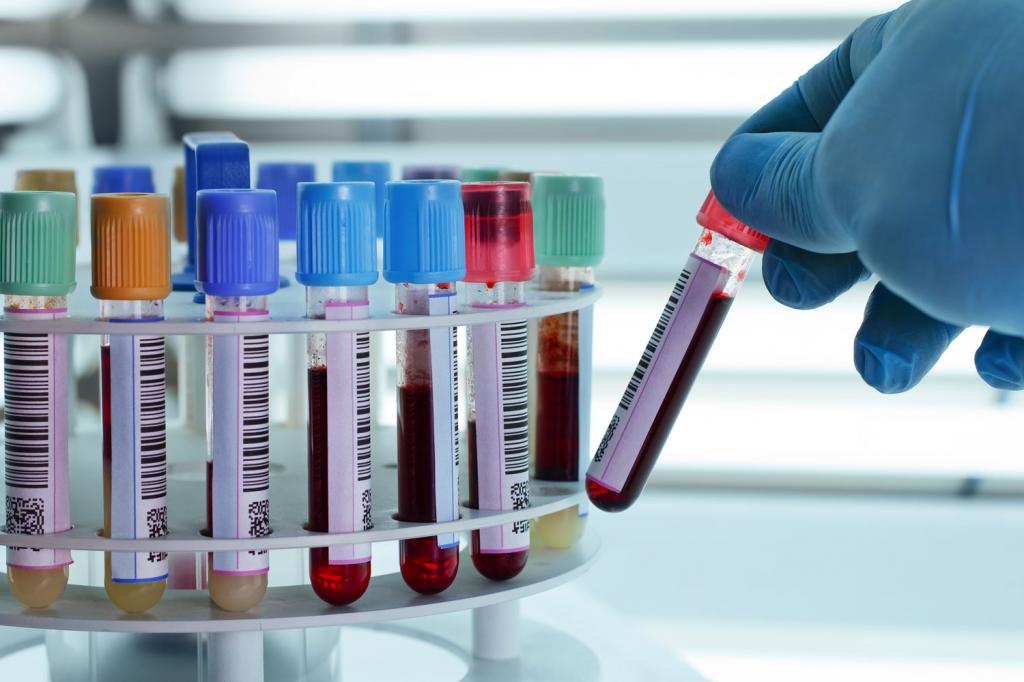 Биохимический анализ крови: показания к назначению